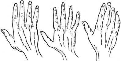 THE CONIC OR ARTISTIC HAND - THE PSYCHIC OR IDEALISTIC HAND - THE MIXED HAND